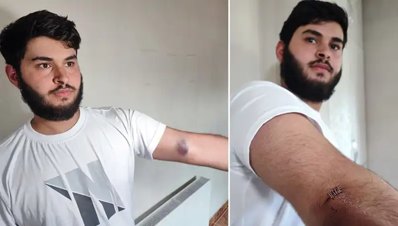 Bahçeye Kaçan Top, Kamyonetle Gelen Conolarla Mahalleyi Karıştırdı